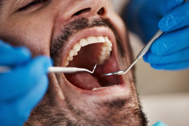 Best Walk-In Emergency Dentist in Audubon, IA