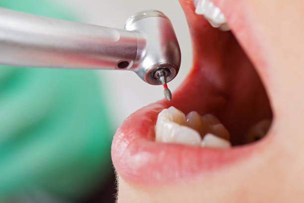 Best Emergency Treatment for Toothache in Audubon, IA